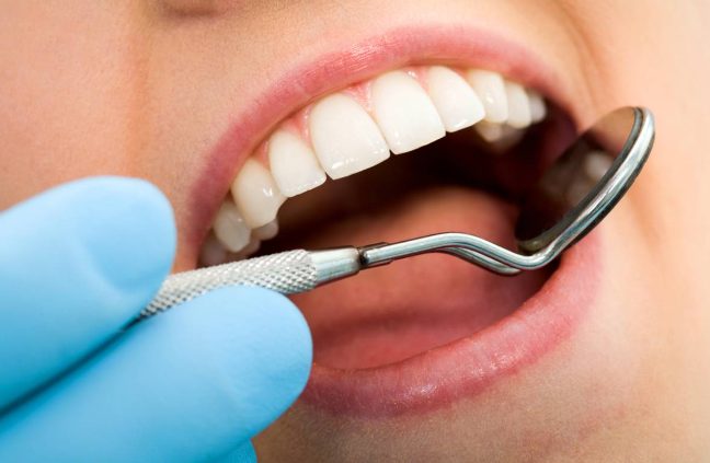 Advantages of Opting for a Local Dentist