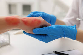 Virginia’s Most Serious Injury and Toxic Exposure Cases
